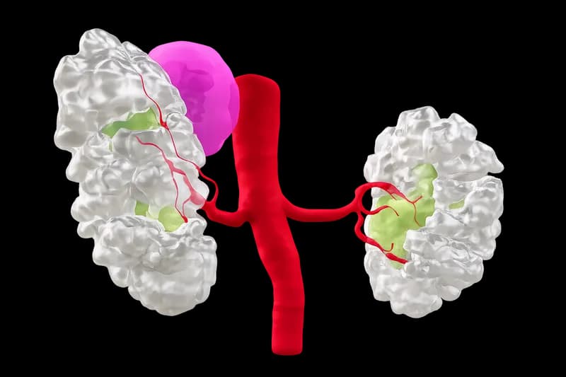3D Segmentation