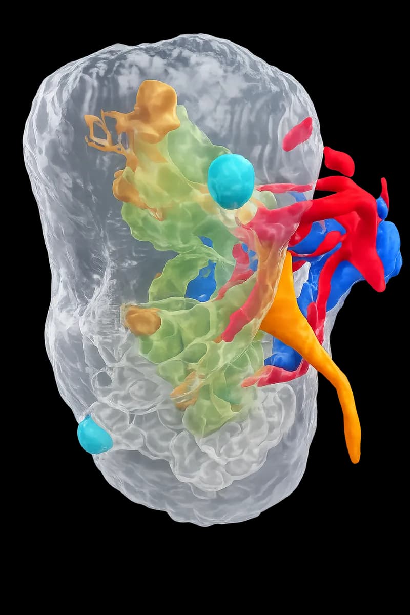 3D representation of a renal surgery procedure